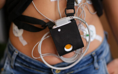 Šta je holter monitoring ekg-a?