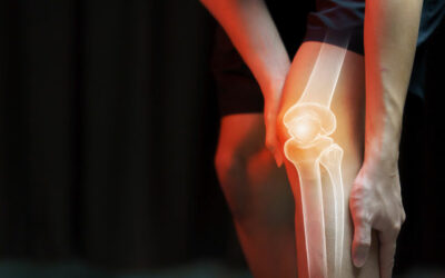 Osteoporoza (poroznost kostiju)